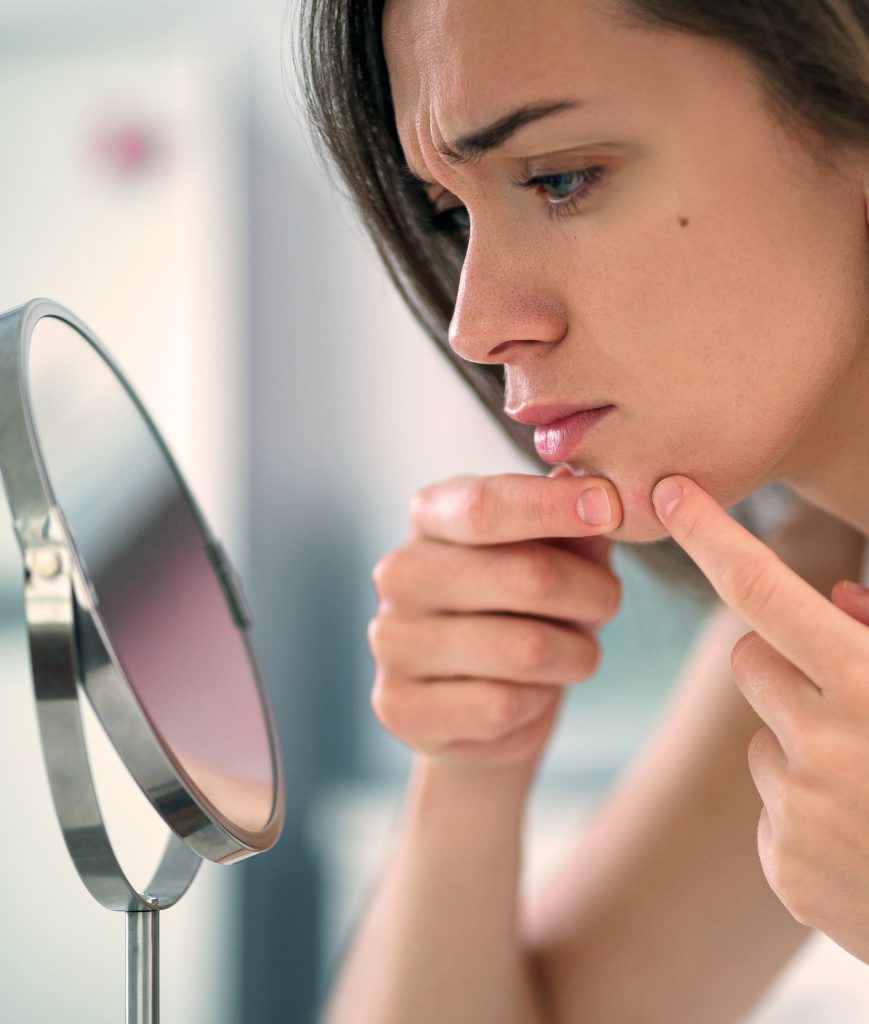 Woman squeezing her pimples while looking in the mirror