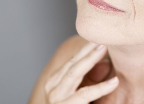 Aging face and neck on a woman