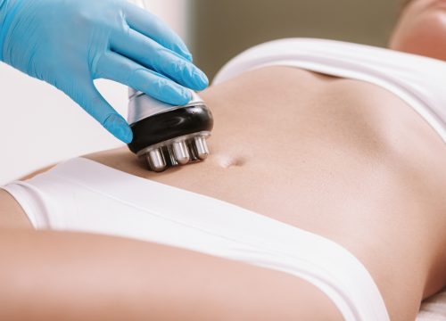 Woman receiving fat reduction treatments